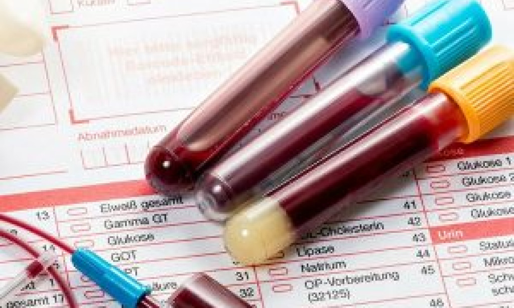 STD Test in Dubai: How to  Guide to Private Sexual Health