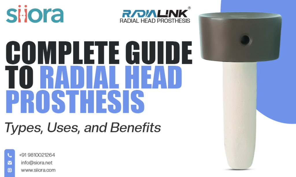 What is Radial Head Prosthesis? Types, Uses, and Benefits