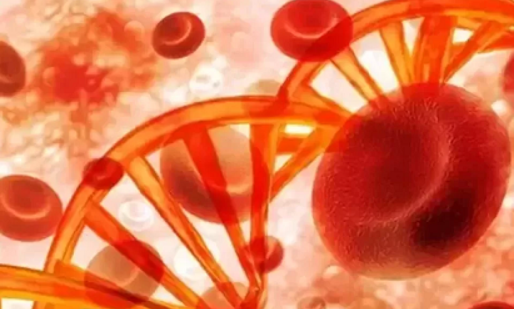 Top Light in the Genetic Maze: A Global Perspective on the History and Future of Shwachman-Diamond Syndrome