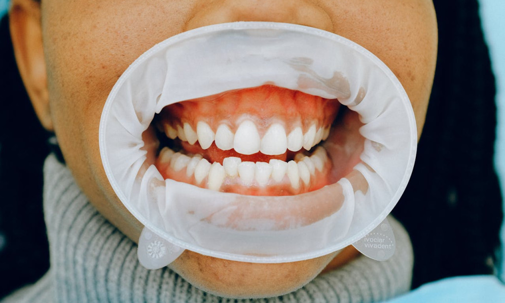 Top Dental Care in Sea Girt, NJ: Why Prevention Starts Early for Lifelong Healthy Smiles