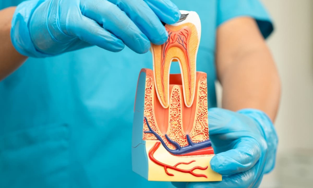Top Ways to Reduce Your Root Canal Treatment Cost Without Compromising Quality