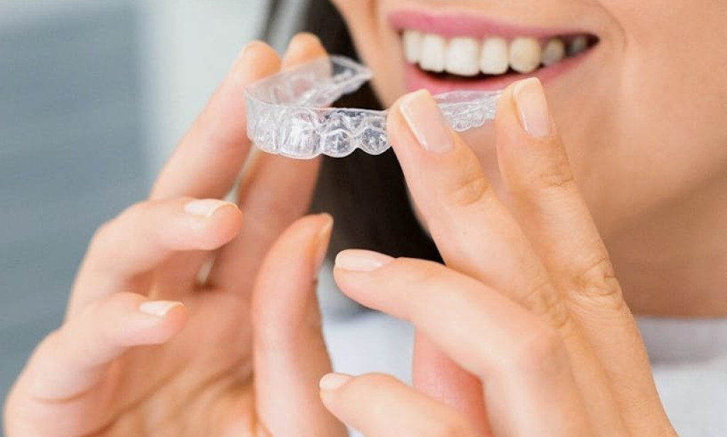 How Invisalign Adelaide Helps Straighten Teeth
