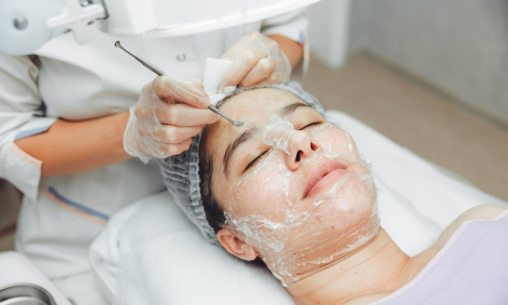 How Can Inno Peel Treat Post-Inflammatory Red Marks Safely?