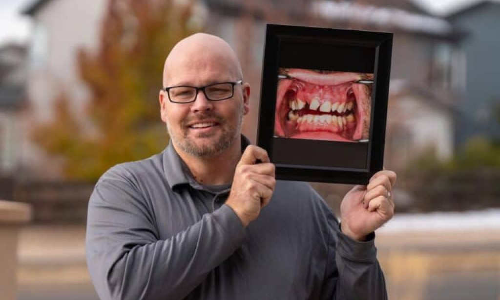 Are Dental Veneers Worth the Cost? Top Benefits and Long-Term Value