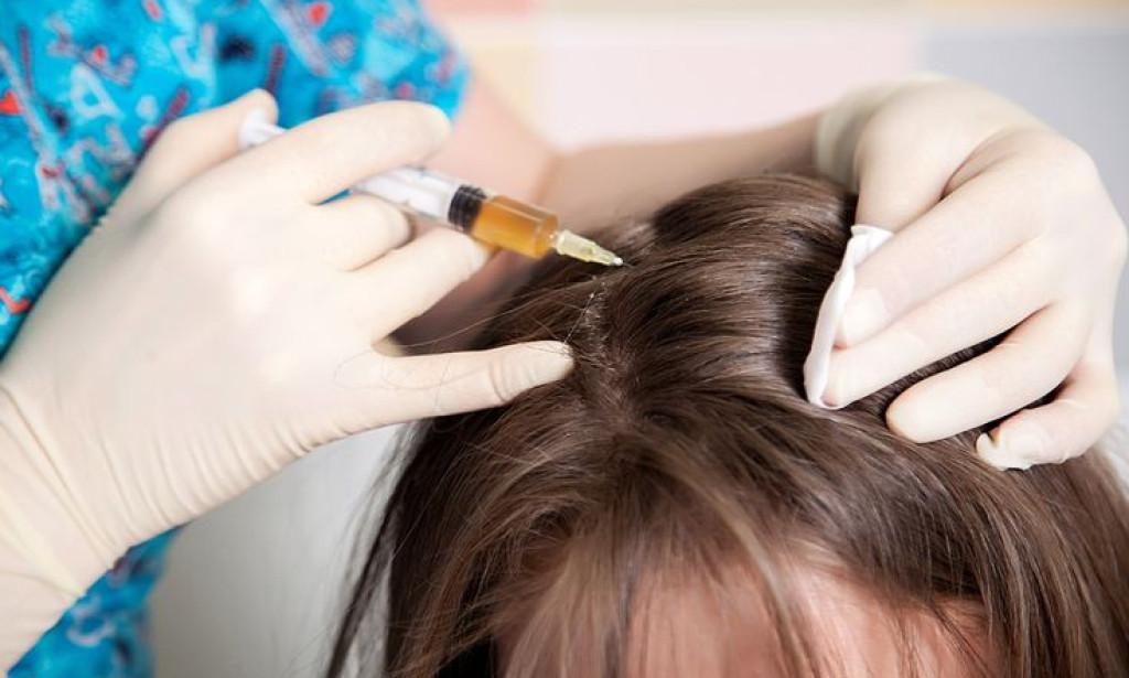 How Can GFC Treatment For Hair Reduce Hair Fall Over Time?