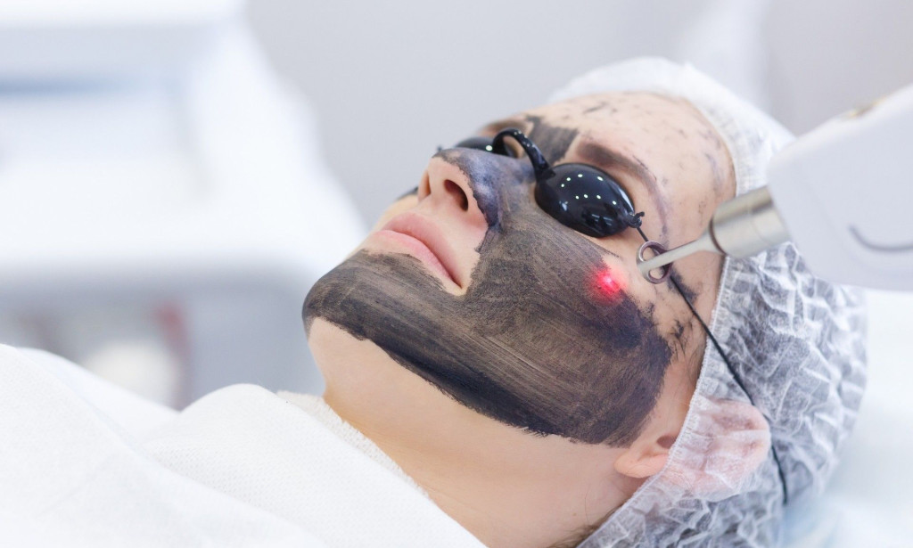 How Can Laser Carbon Peel Rejuvenate Skin After Stress or Fatigue?