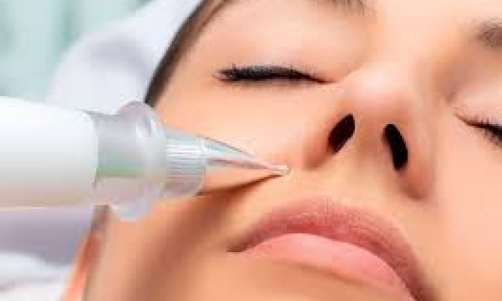 How Does Plasma Pen Treatment Work for Skin?