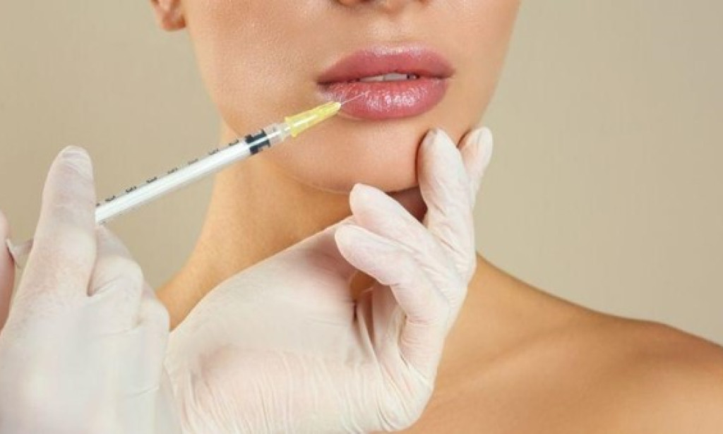 How Do Russian Lip Fillers Create A Minimal Yet Stunning Look?