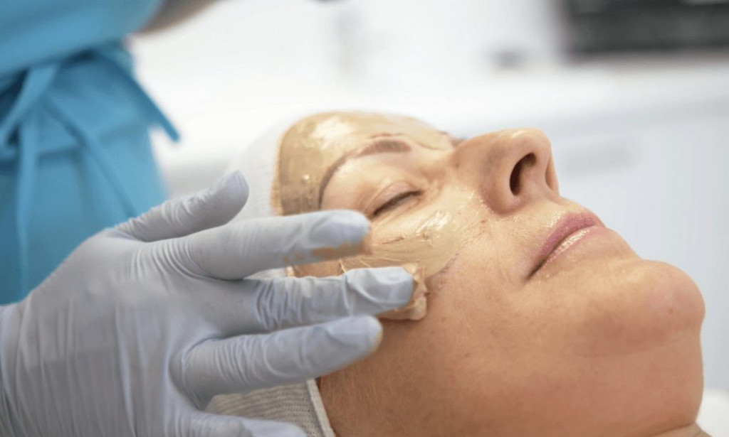 How Can Cosmelan Peel Treatment Clear Skin Imperfections Naturally?