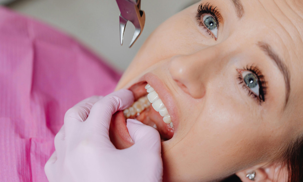 Top Safe and Comfortable Wisdom Tooth Extraction for Better Oral Health