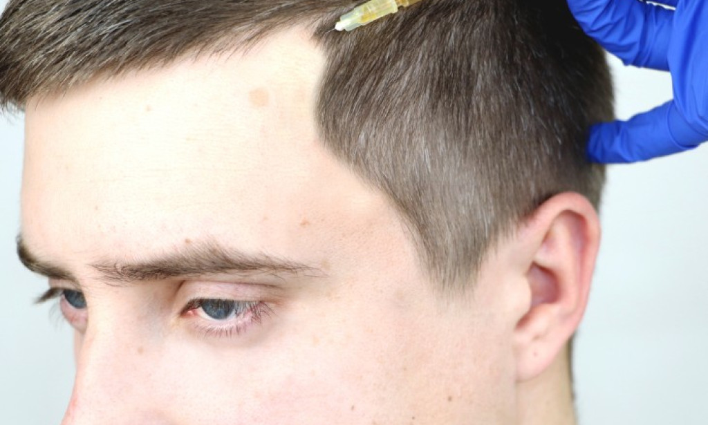How Does GFC Treatment Improve Hair Growth?
