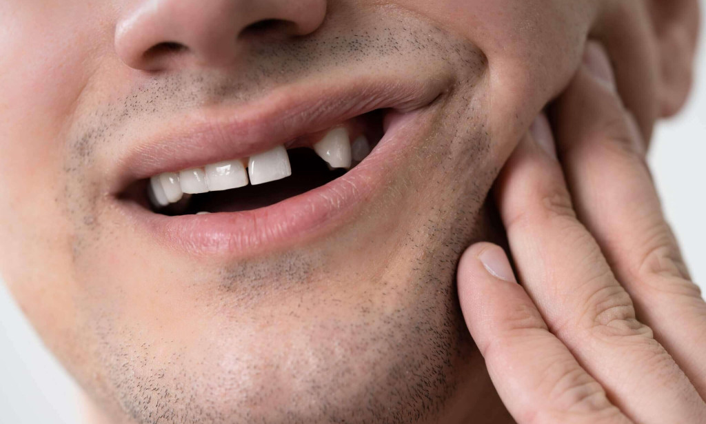 How do Dental Implants Replace Teeth Permanently