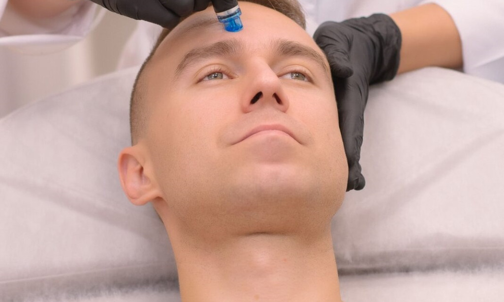 How Does Hydrafacial Maintain Smooth Skin Through Exfoliation?