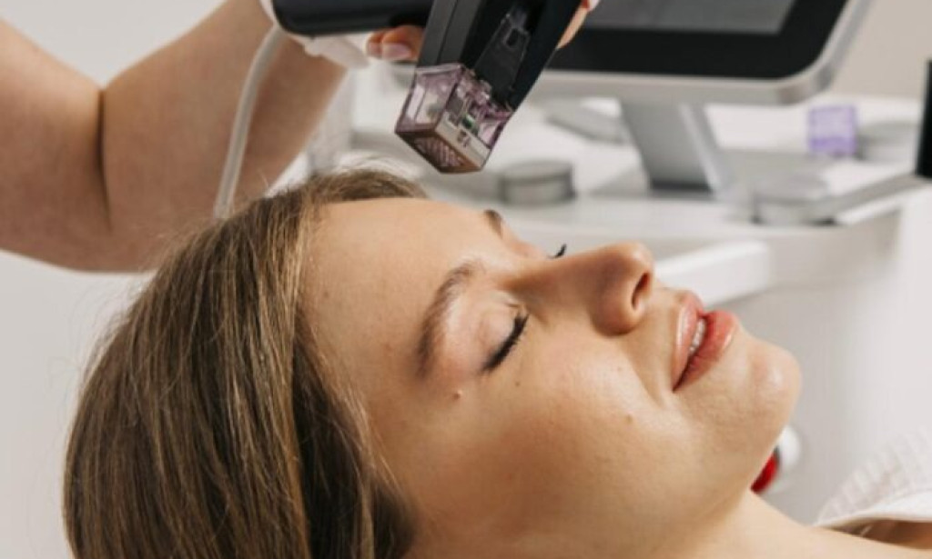 What Should You Expect After Morpheus8 Skin Tightening?