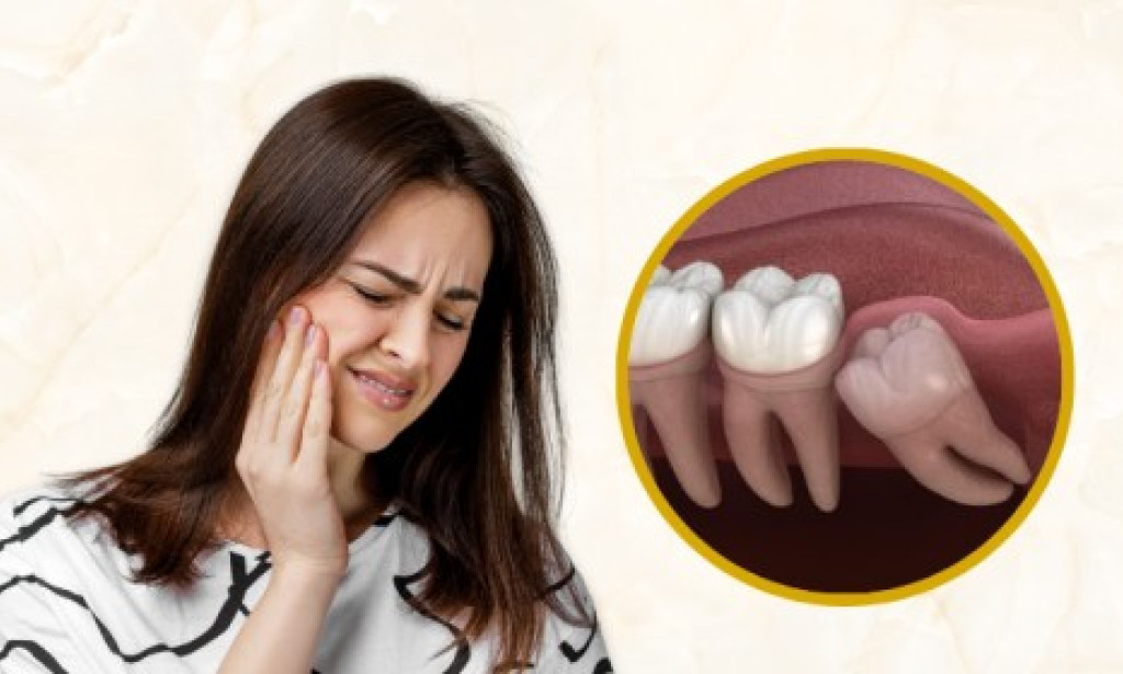Top Signs and Symptoms of an Impacted Wisdom Tooth You Shouldn’t Ignore