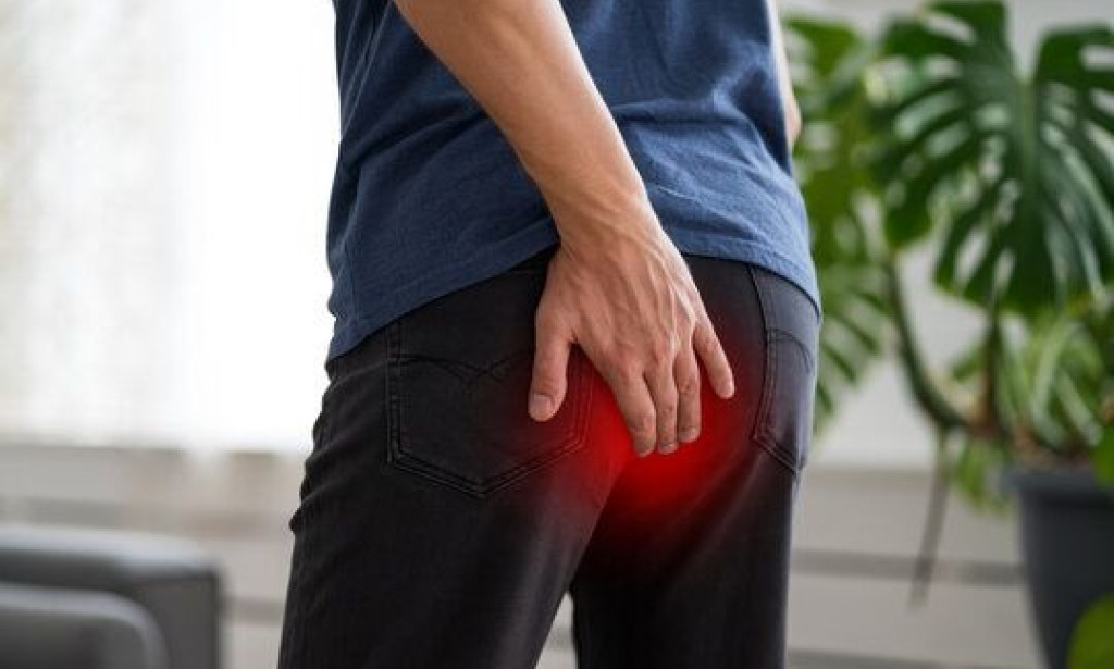 Pilonidal Sinus Treatment in Delhi: Why the Problem Returns & How to Avoid Repeat Surgery
