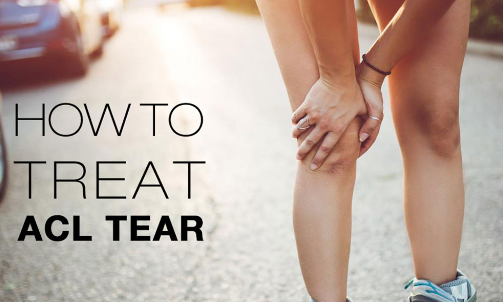 ACL Tear Symptoms: Early Signs, Surgery & Recovery