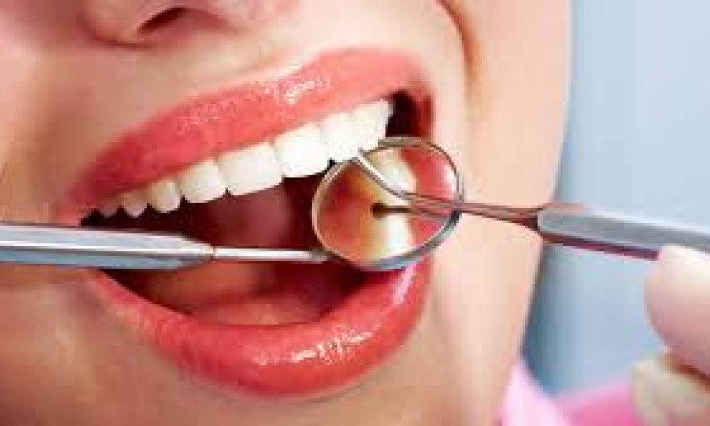 All-on-4 Dental Implants in Turkey: The Ultimate Guide for Patients How to choose Full-Mouth Smile Restoration