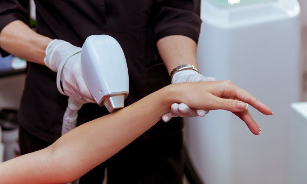 Laser Hair Removal in Dubai: How to Achieve Permanent Results Safely