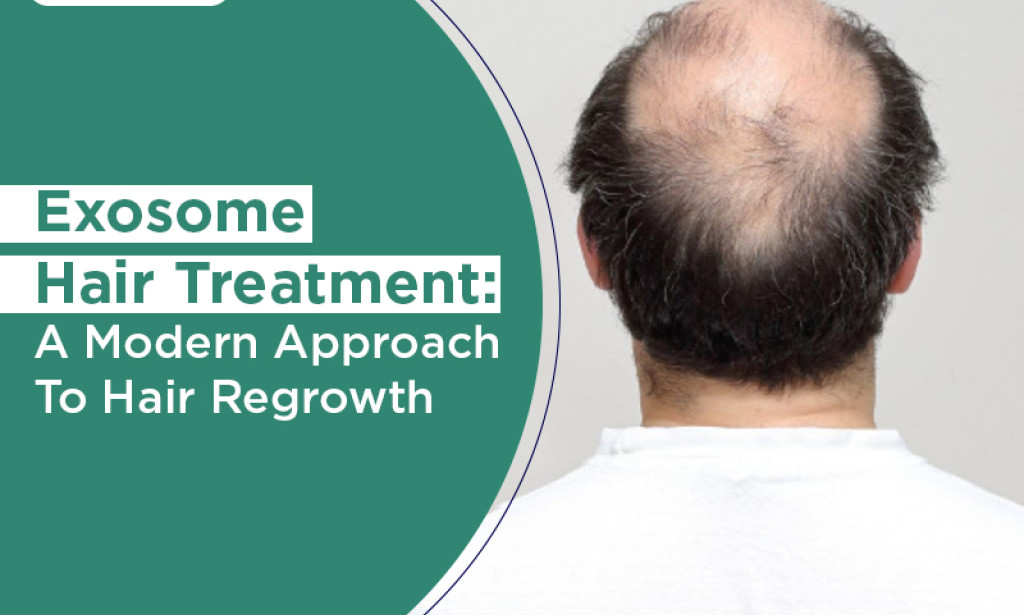 What Exosome Hair Treatment: A Modern Approach to Hair Regrowth