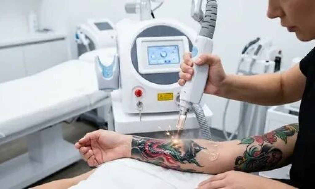 How Can Laser Tattoo Removal Remove Old and Faded Tattoos?