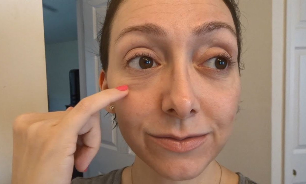 How Can Under-Eye Filler Treatment Reduce Eye Bags Appearance?