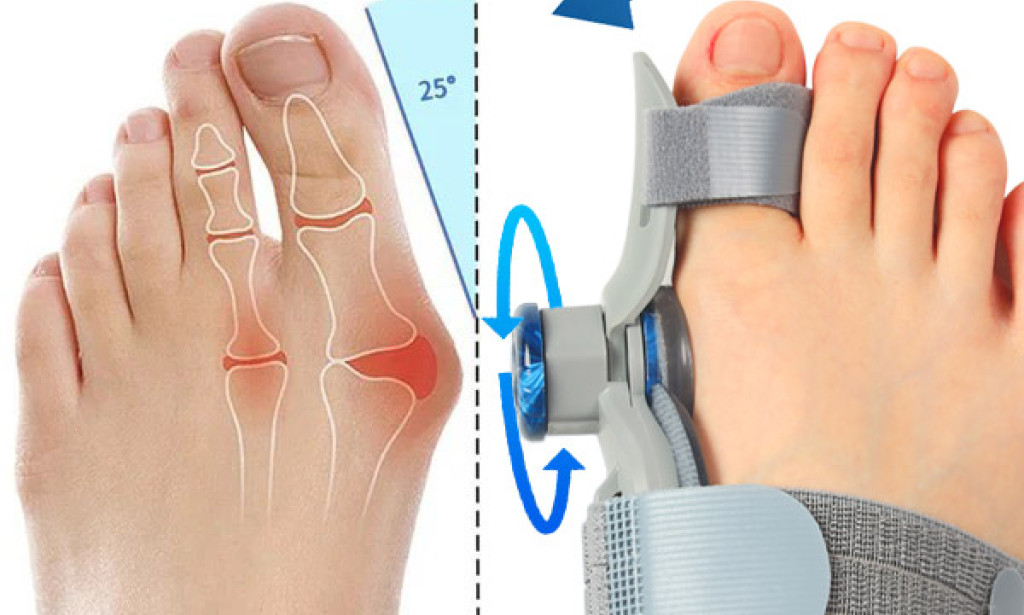 Where To Buy BuniCure Australia