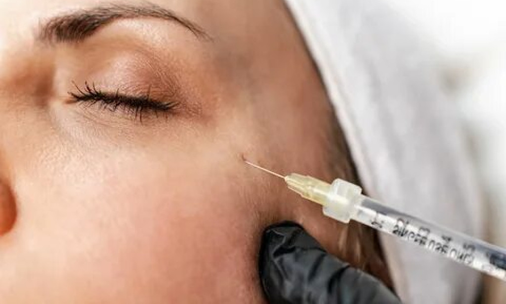 How Can Dermal Fillers Make the Face Look Younger?