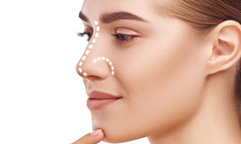Rhinoplasty in Dubai:How to Achieve Natural Facial Balance