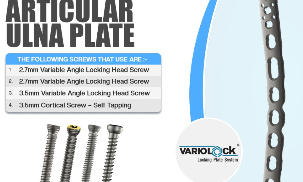 What Are the Benefits of Using Extra Articular Ulna Plate in Forearm Fracture Treatment?