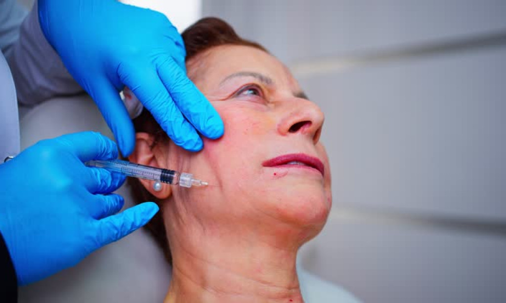 What Areas Benefit Most From Sculptra Filler Treatment?