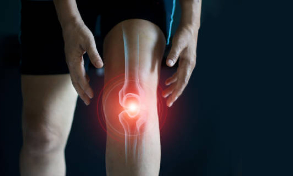 How Physiotherapy Helps Arthritis Patients Achieve Long-Term Joint Health