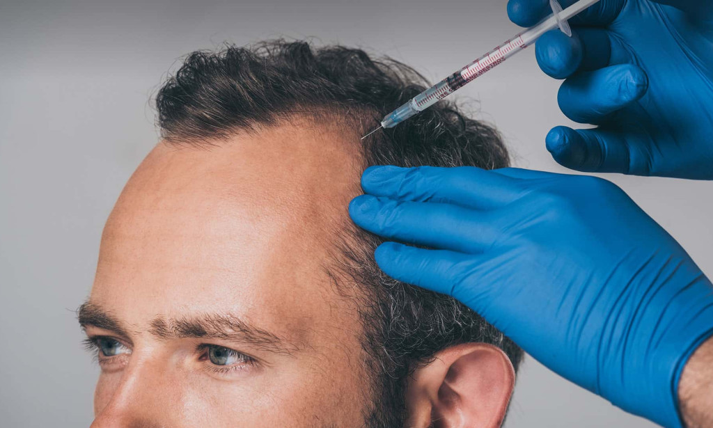 How Much Hair Growth Is Possible With G Cell Treatment?