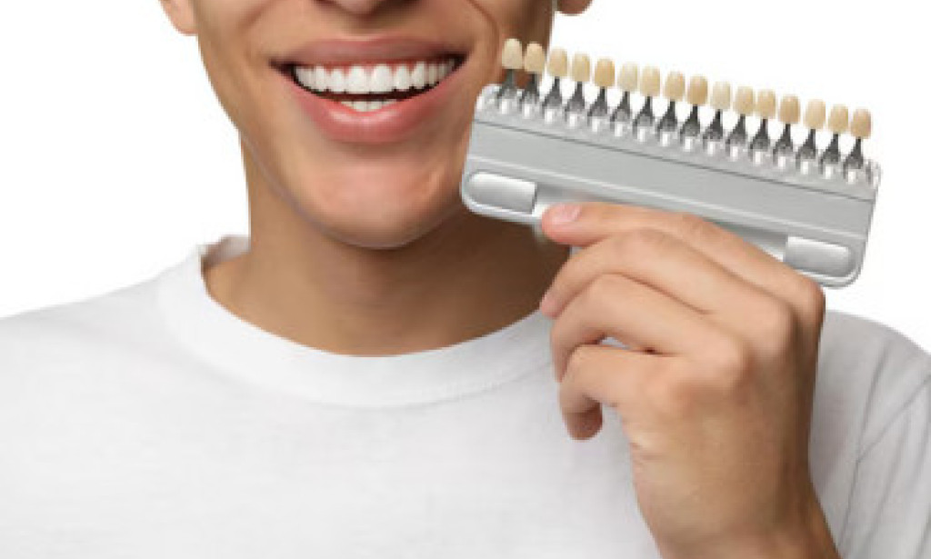 Dental Veneers: Top Lasting Solution for Fix Dental Chipped Teeth