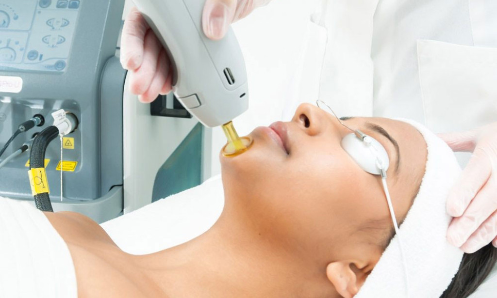 Laser Hair Removal in Dubai: What are Expert Guide to Smooth Skin