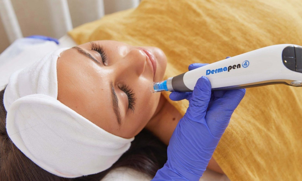 How Does Dermapen Microneedling Refresh Dull-Looking Skin?