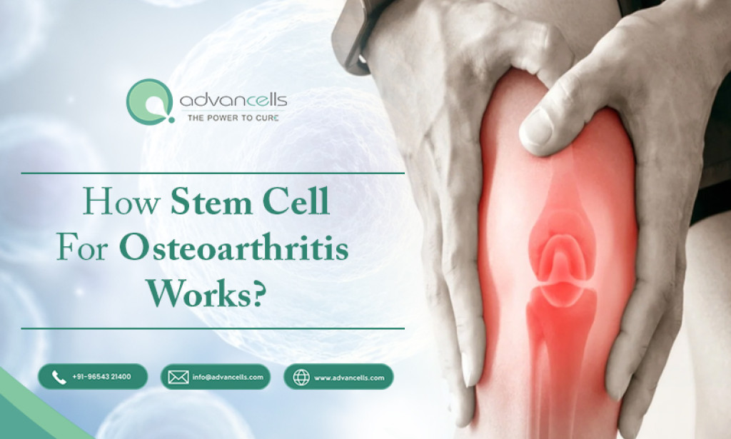 What Osteoarthritis Stem Cell Treatment: A New Frontier in Joint Regeneration