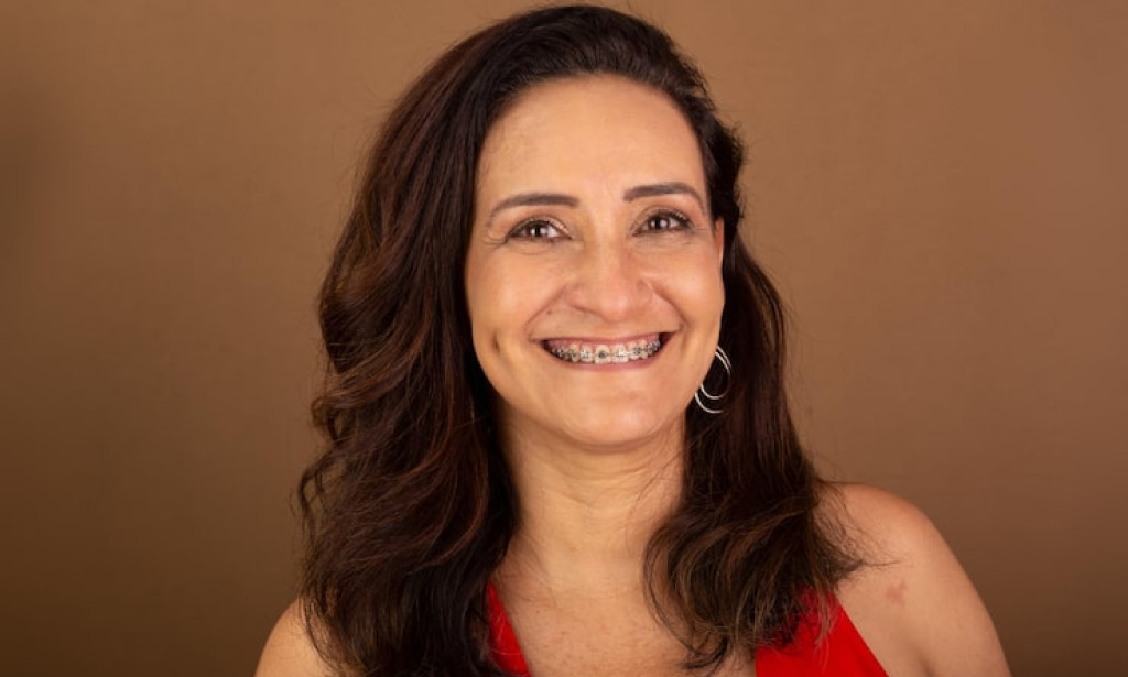 Top 10 Braces for Adults Thousand Oaks Orthodontists Recommend Today