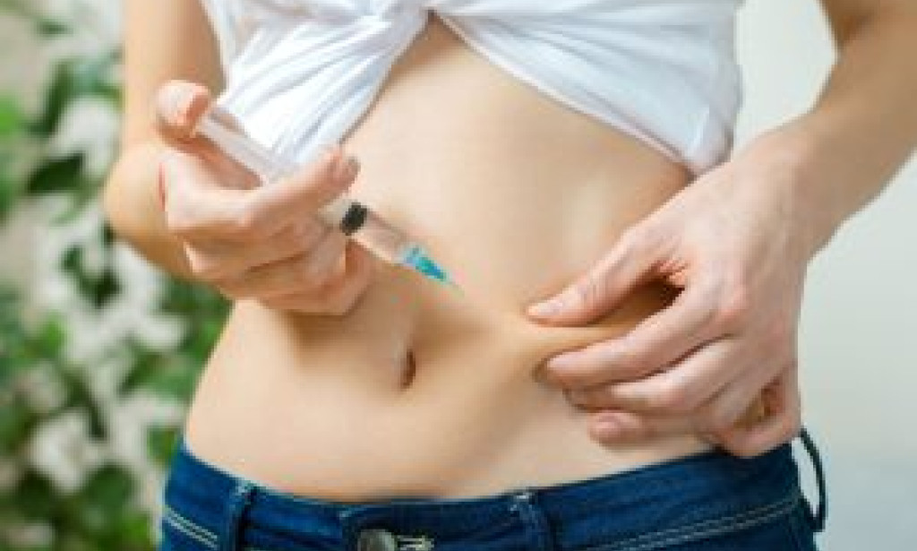 What is Fat-Directed Injections in Dubai: Your Guide to Natural Volume
