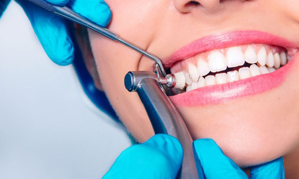 Top Teeth Cleaning Guide: Procedure, Benefits & Long-Term Oral Health