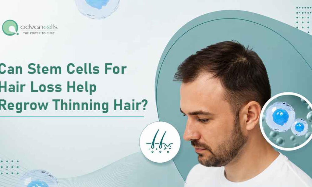 What Can Stem Cell for Hair Loss Help Regrow Thinning Hair?