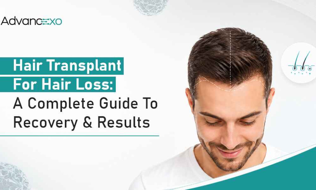 What Hair Transplant for Hair Loss: A Complete Guide to Recovery and Results
