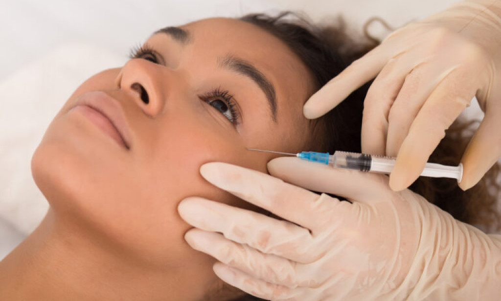 How Do Sculptra Fillers Improve Facial Shape and Balance?