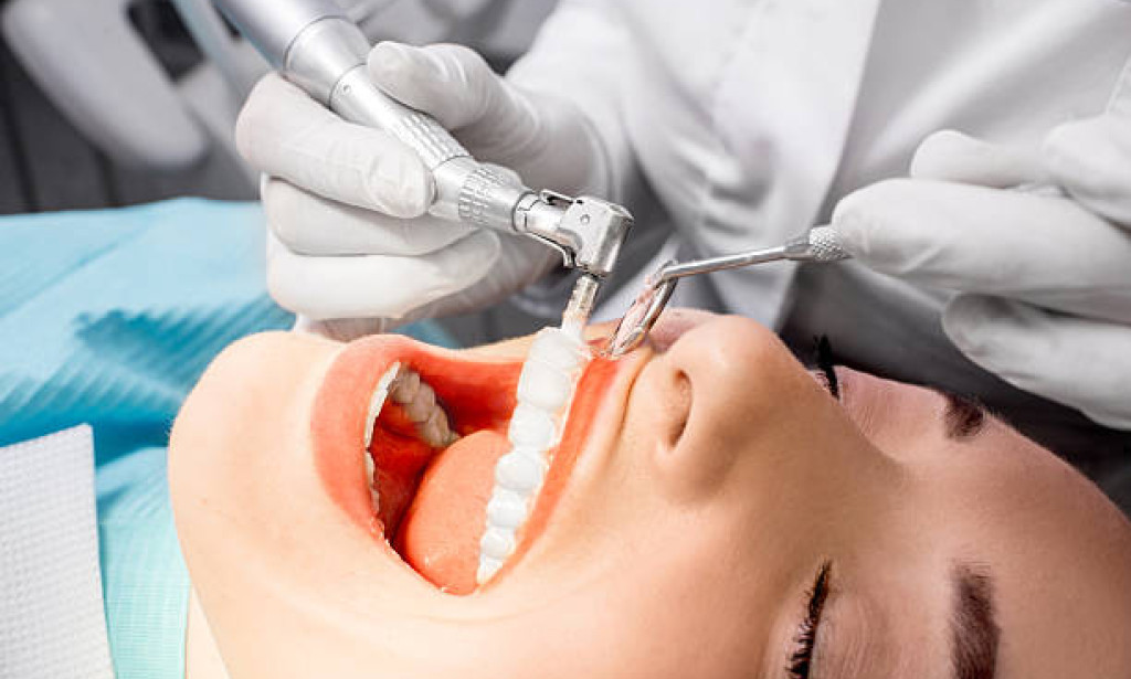 Teeth Cleaning & Polishing: Why It’s More Important Than You Think