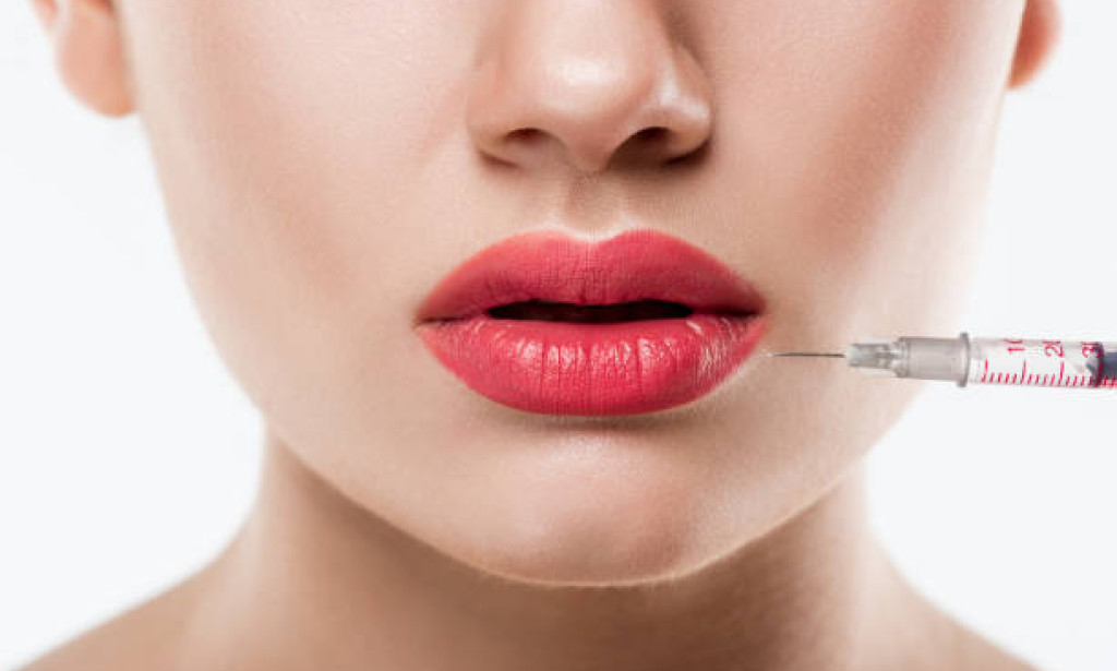 How Soon Can You See Results From Lip Filler Injections?