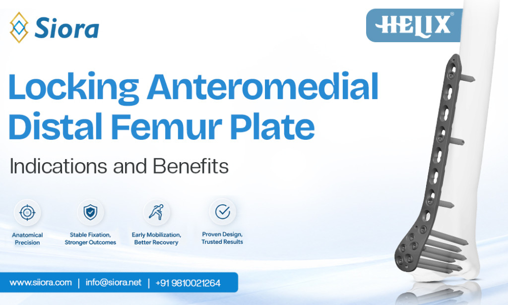 What Is a Locking Anteromedial Distal Femur Plate? Indications and Benefits
