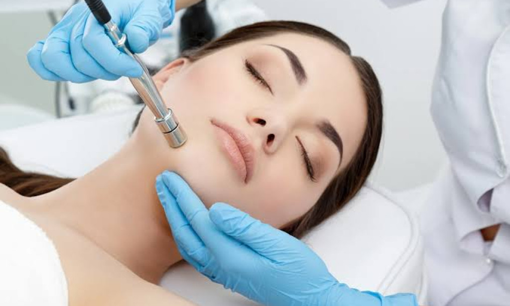 How Microdermabrasion Fits Into Skin Care