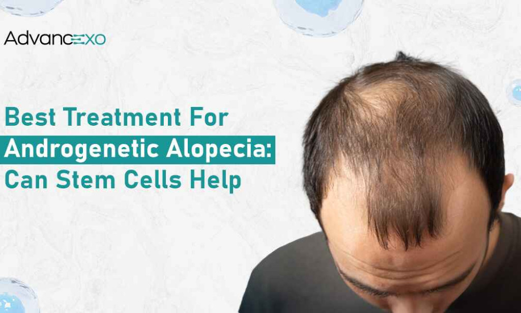 What Best Treatment for Androgenetic Alopecia: Can Stem Cells Help