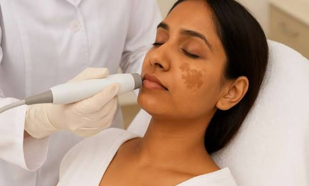 Is top Pigmentation Treatment Right for Different Skin Types?