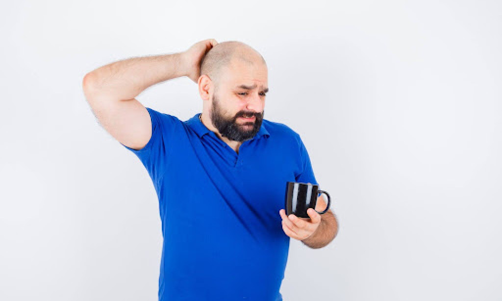 Top Protecting Your Investment: Why You Still Need Hair Loss Meds After Your Transplant